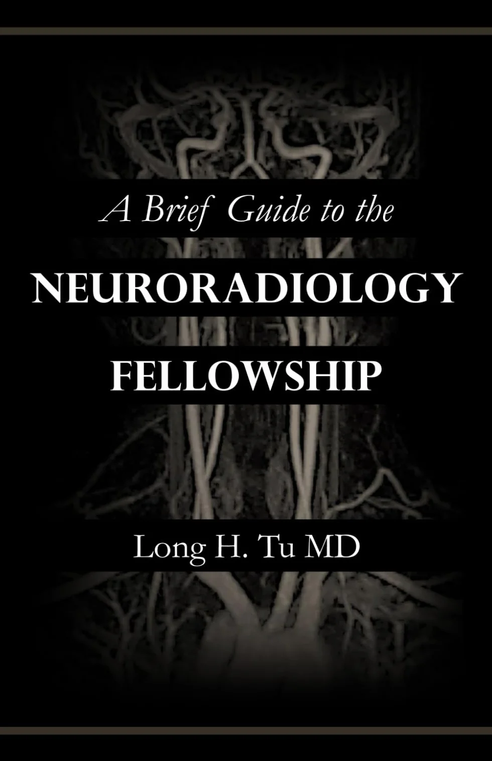 A Brief Guide to the Neuroradiology Fellowship
